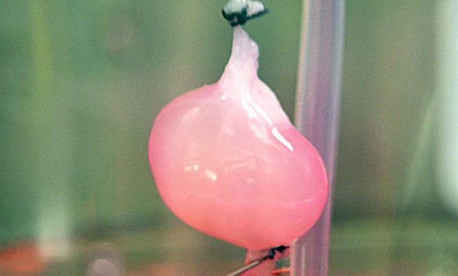 A new functional rat kidney is harvested from the scaffold of an old one.