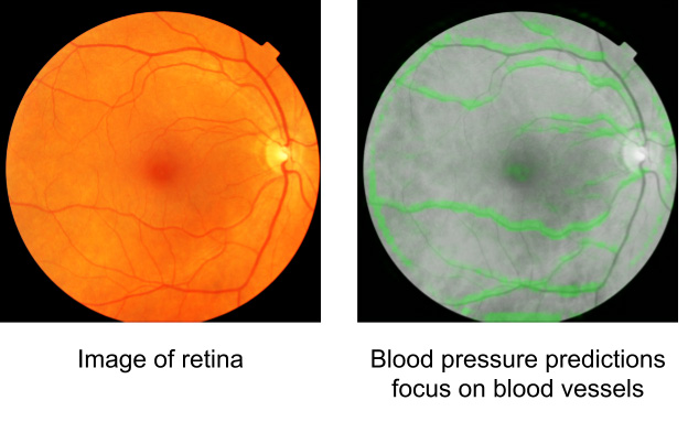 A retina.