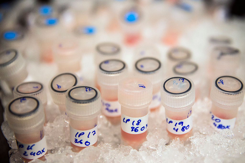 Cancer cell samples in a lab.