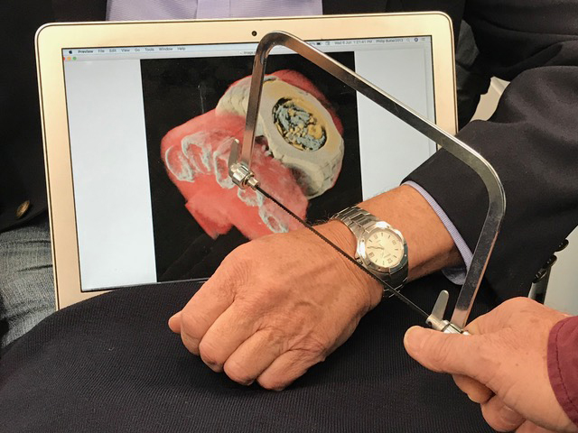 A mans hand is scanned with a color Xraay showing a cutaway of his wrist with watch