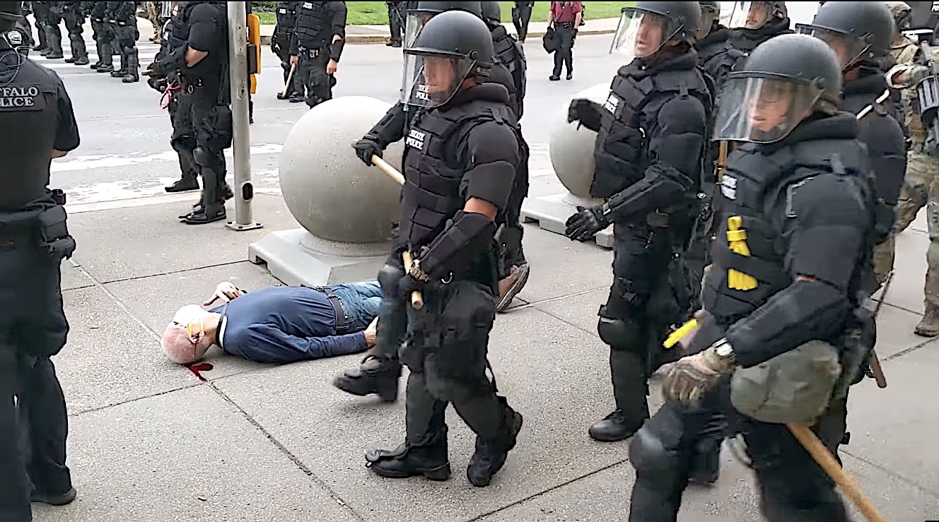 Police shoved protester in Buffalo