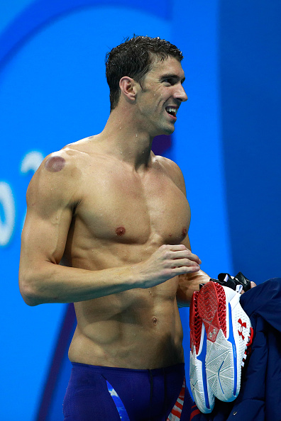 Michael Phelps and other swimmers sported red circles on their bodies, marks of a traditional Chinese practice known as &#039;cupping.&#039;