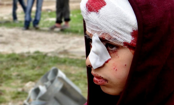 A Syrian child, injured by heavy bombing from military warplanes, March 1.