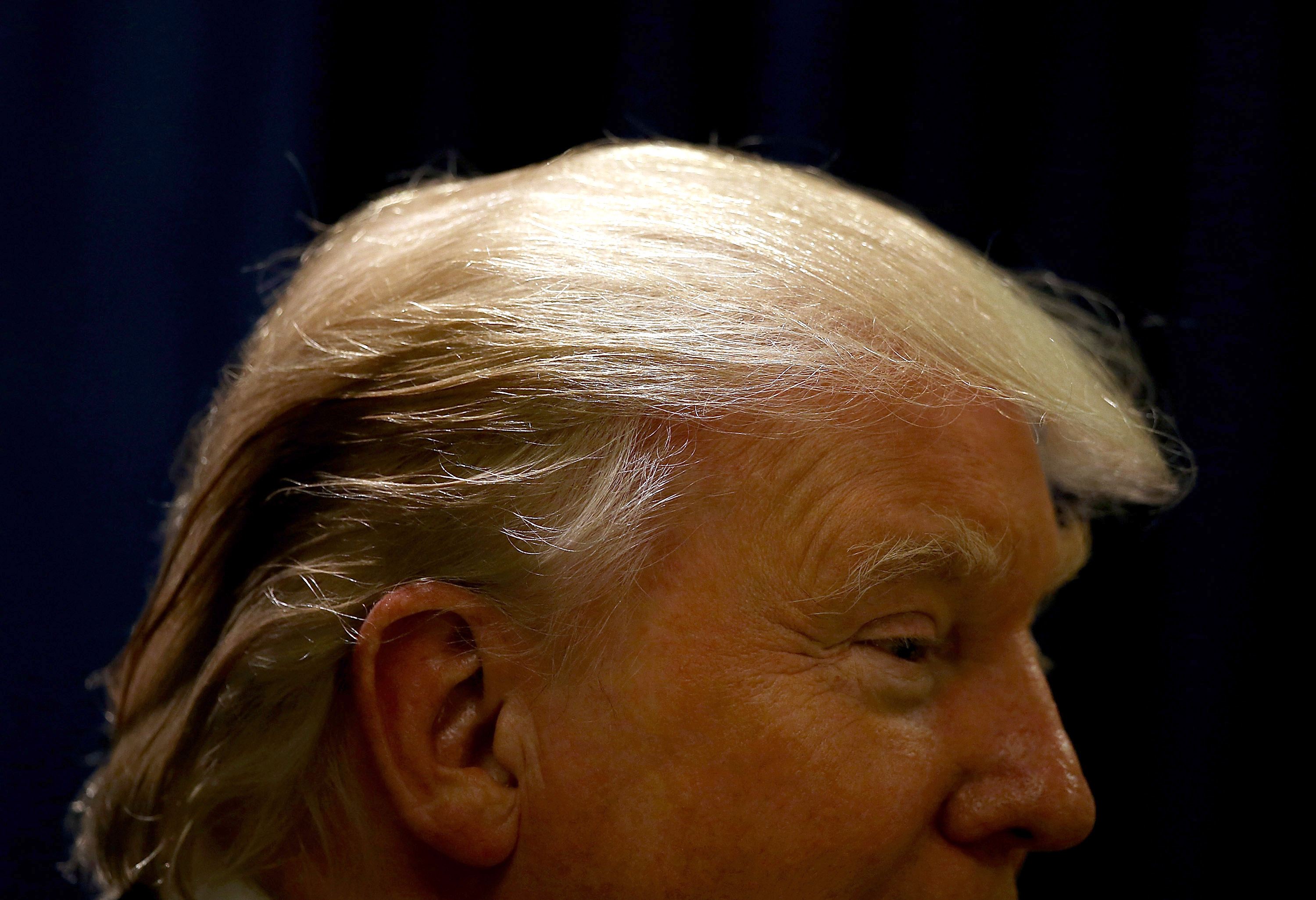Donald Trump sports a fascinating set of hair.