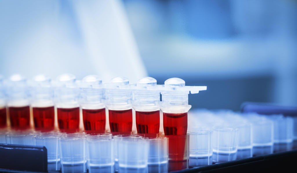 A new blood test may determine suicide risk