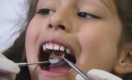 Researchers have discovered that dental sealants contain the toxic chemical BPA (bisphenol-A).