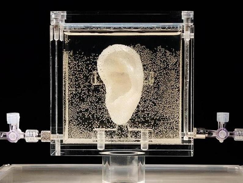 Artist creates replica of Van Gogh&#039;s ear using living cells from relative