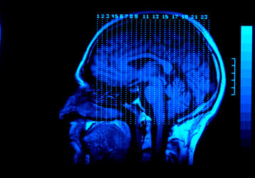 Brain scans might predict recovery potential for vegetative patients