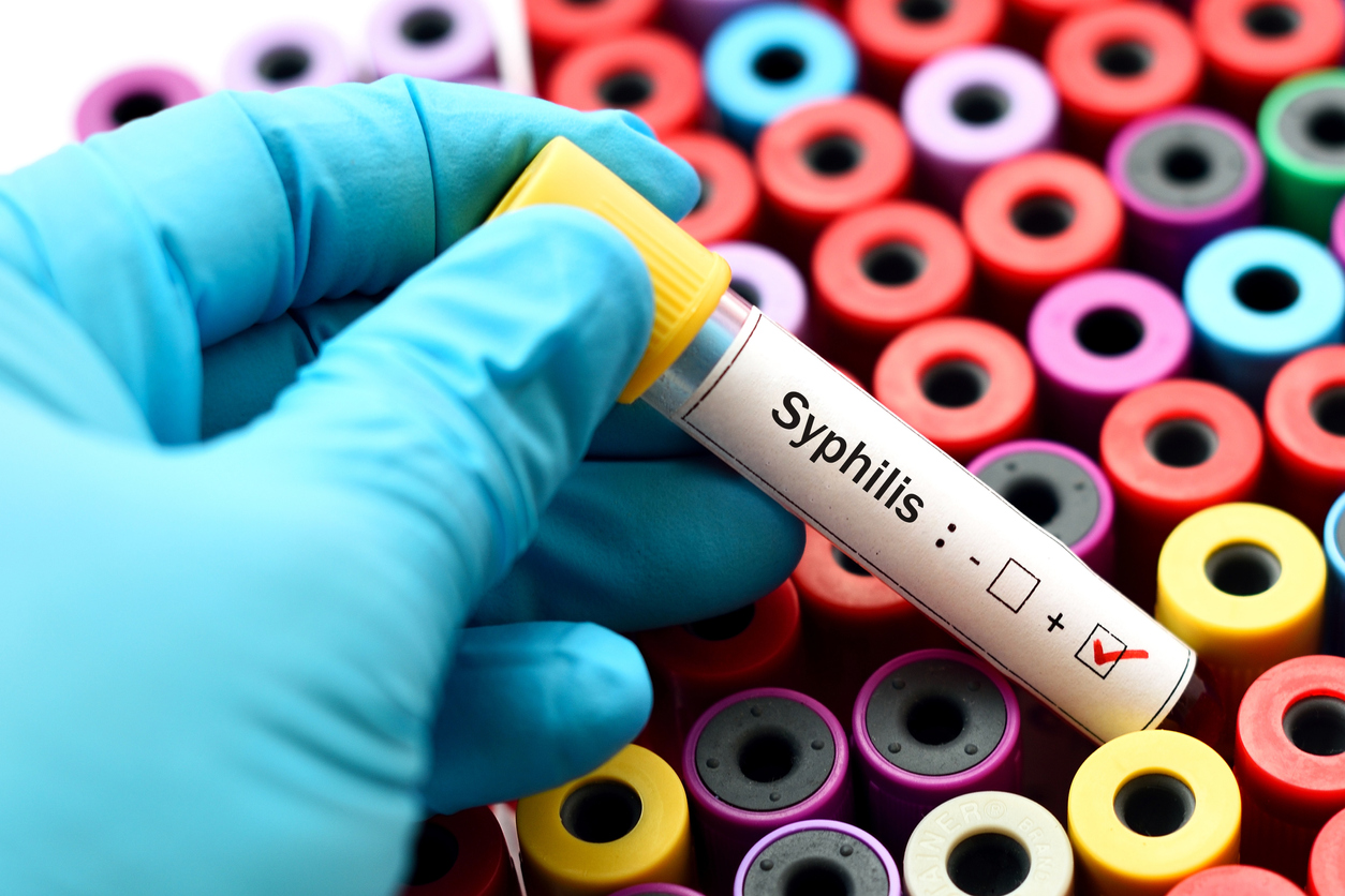 Syphilis testing tube. 