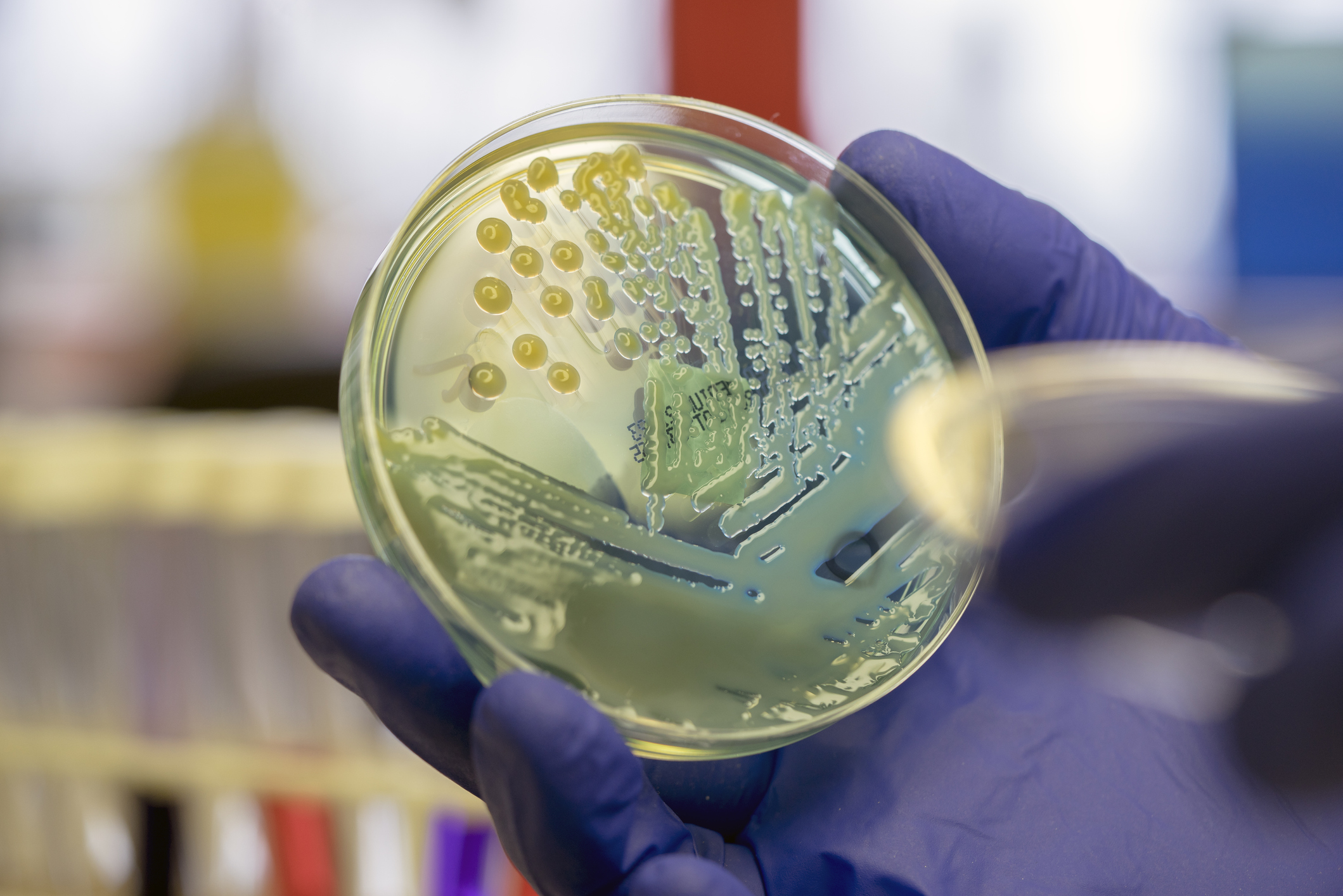 Bacteria on agar petri dish held by gloved hands. 