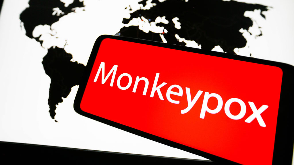 A photo illustration of a global map and the word &quot;monkeypox.&quot;