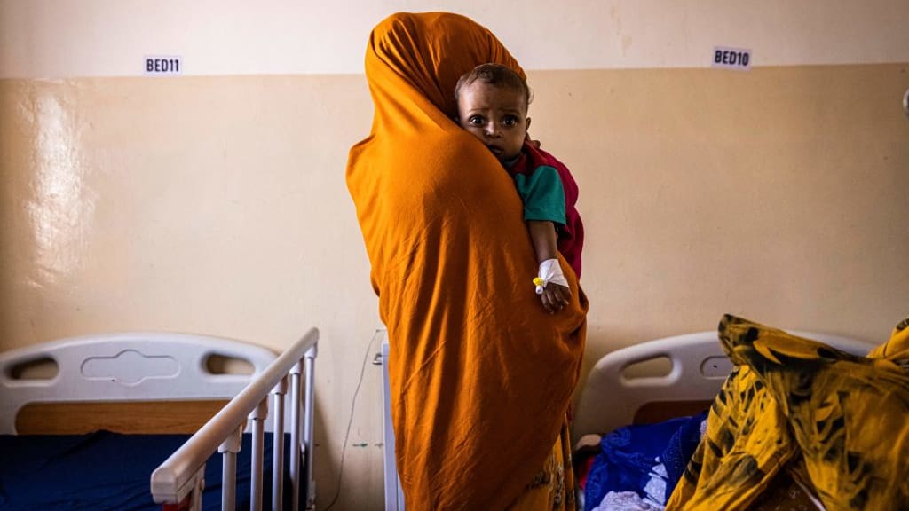 A mother in Mogadishu holds her malnourished baby.