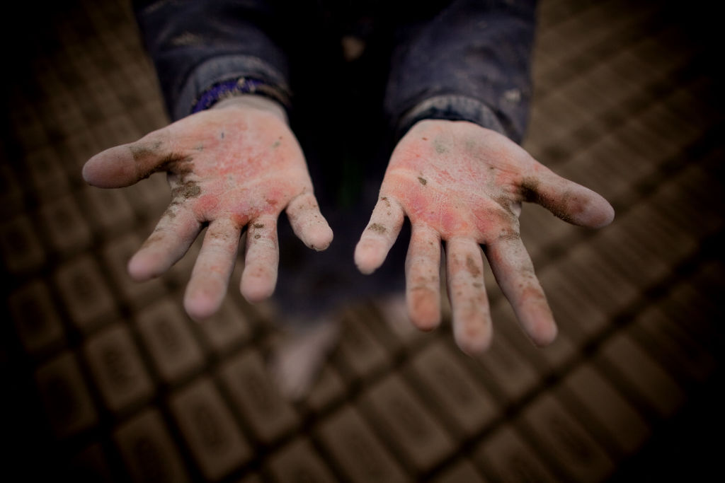 Child hands from working brickyard in Afghanistan